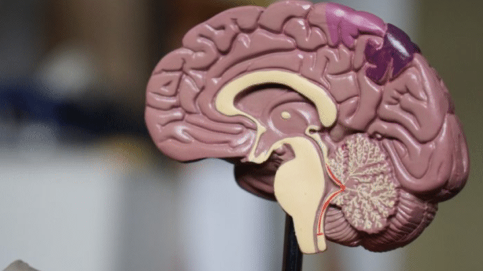 O uso do Lecanemab será restrito a pacientes de Alzheimer com limitações cognitivas leves e que possuam uma ou nenhuma cópia do gene ApoE4 | Robina Weermeijer/Unplash - 5.jun.2019