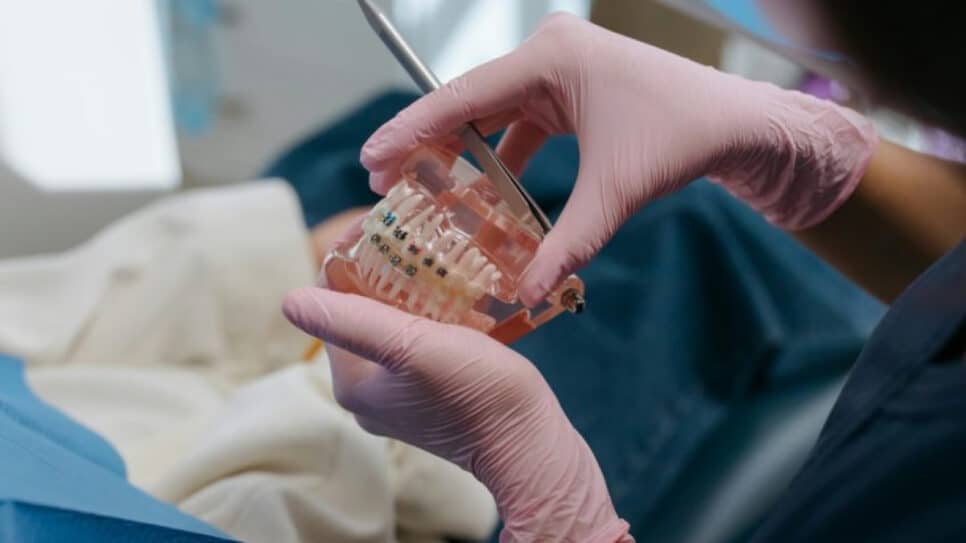 Modelo dental, com aparelho ortodôntico | Cottonbro Studio (via Pexels) - 16.nov.2020